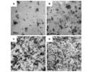 TEM micrographs of PLLA/SiO2 nanocomposites